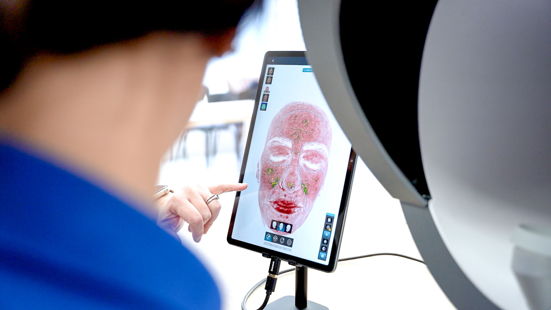 AI skin analysis in progress at Futura Clinic